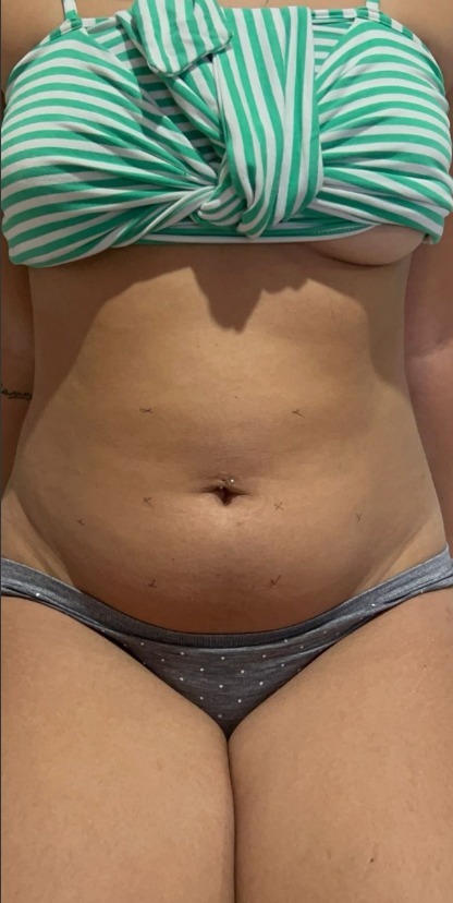 Foto do rosto depois