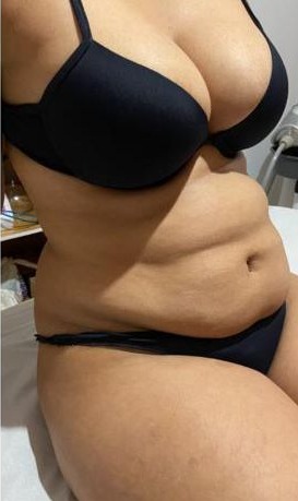 Foto do corpo depois