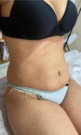 Foto do corpo antes
